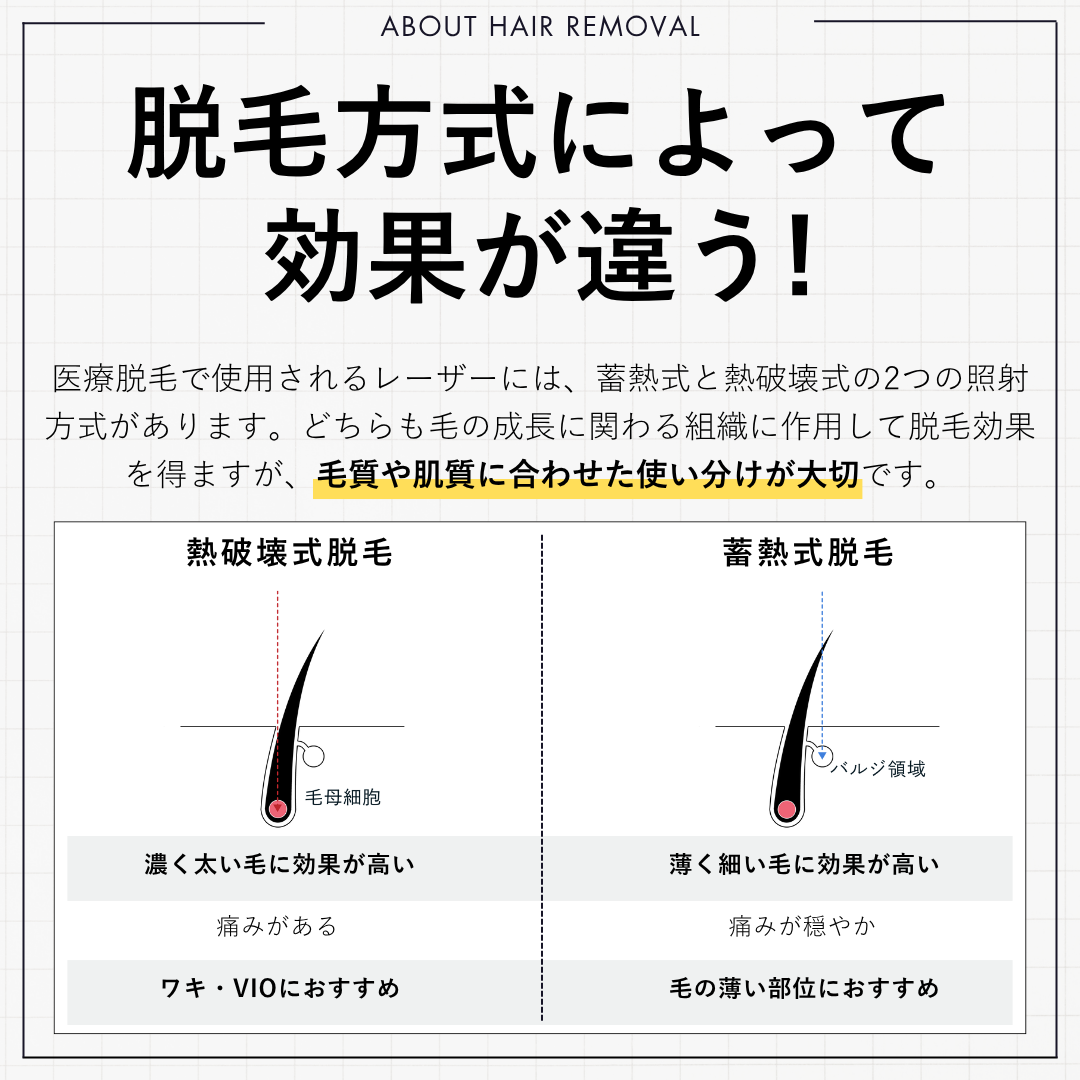 脱毛方式で効果が変わる