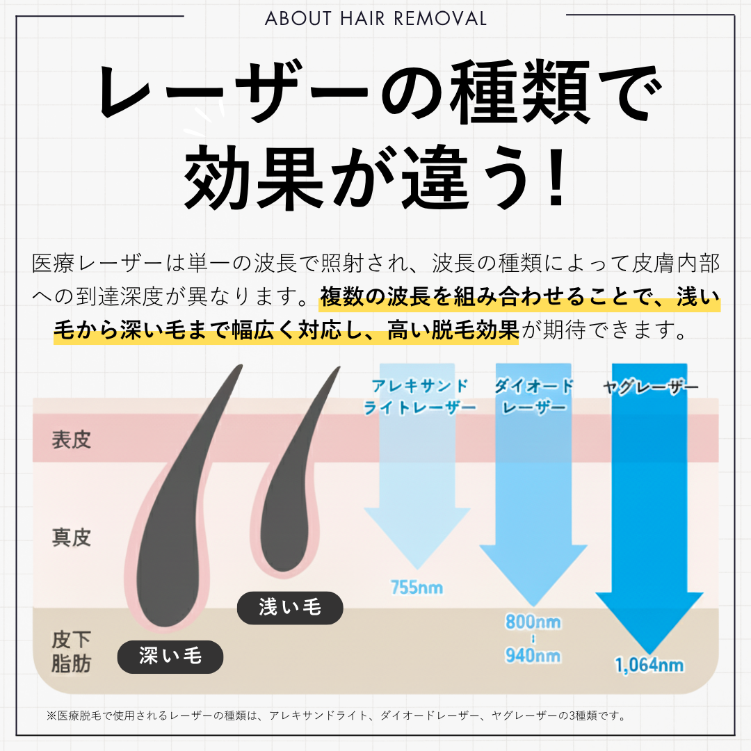 脱毛方式で効果が変わる